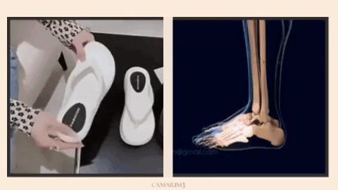 Chinelo Ortopédico para Fascite Plantar